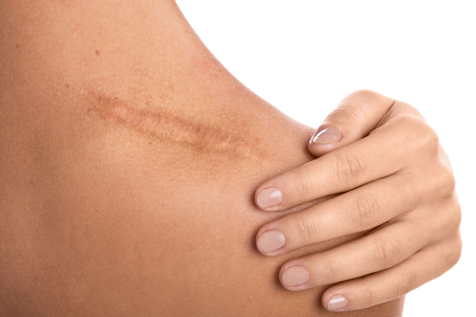 collagen for joint pain menopause